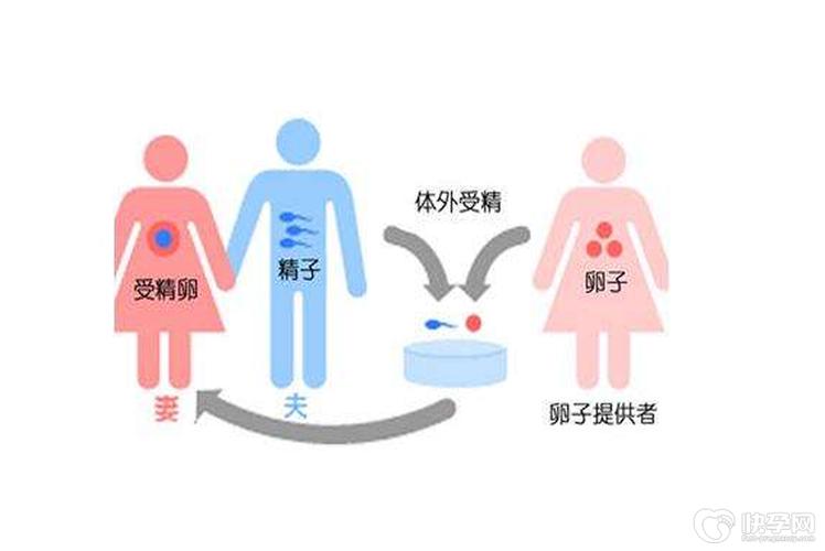 供卵试管婴儿的流程_供卵试管婴儿：全程流程解析