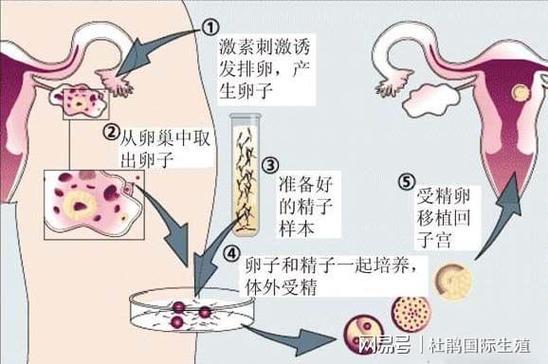 供卵去哪里做比较好【供卵去哪里做比较好？选择最佳供卵地点的指南】